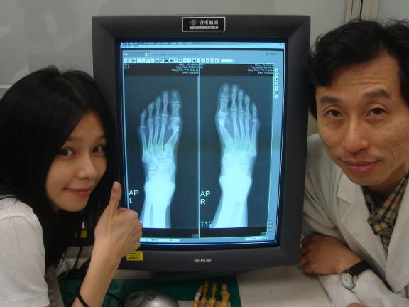 原来这么多明星都有拇外翻?