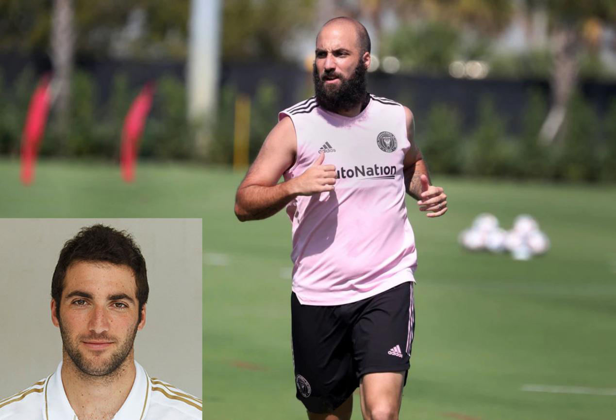 伊瓜因脱发变大叔为什么人到中年会秃头