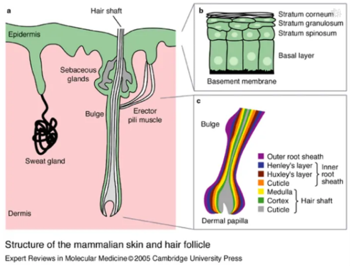 (图为雄激素作用下的毛囊)当然像大家遇见的秃头,发际线后移及额角