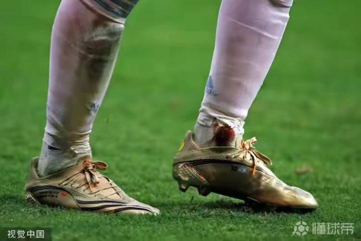 当梅西第一个站在点球点前,脚踝的血还在渗出球袜时.