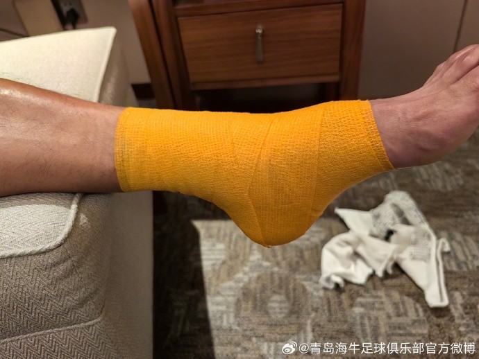 海牛官方：鐘晉寶腳腕腫脹疼痛，回青島后進行核磁共振檢查